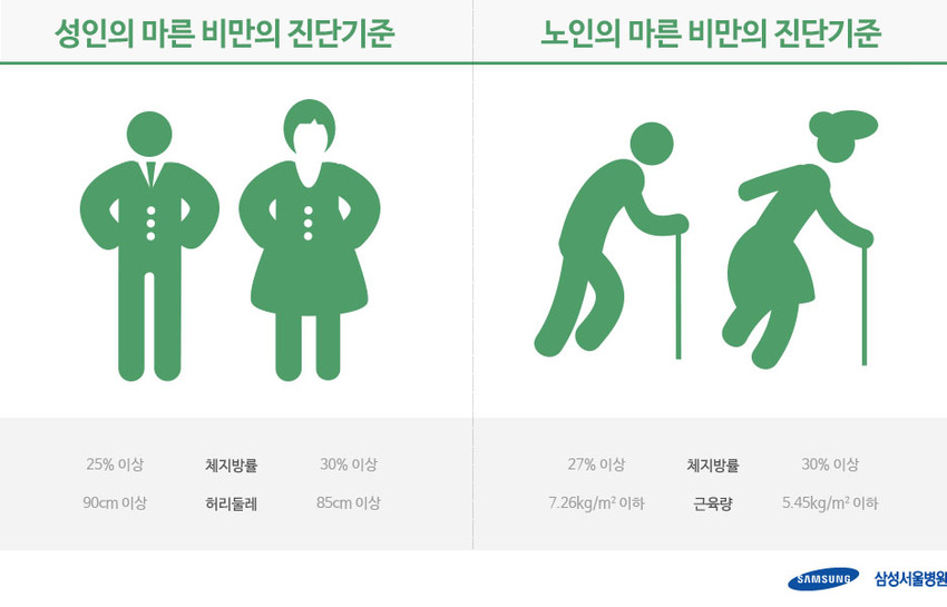  근육 없는 'ET형 몸매', 당뇨병 위험 57% 높다 