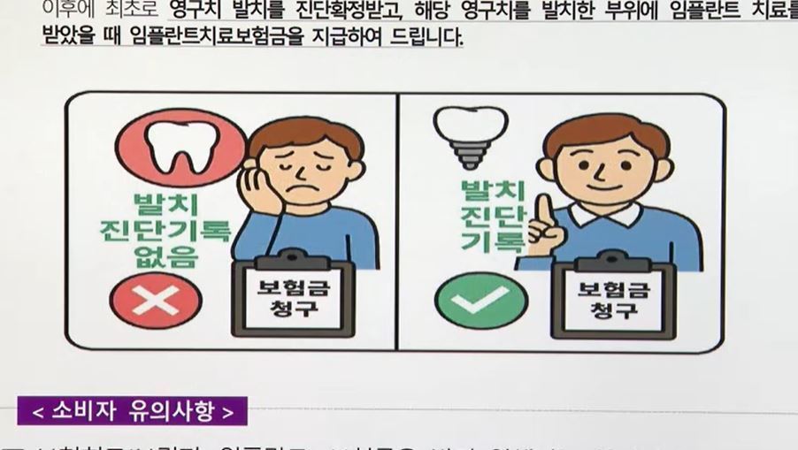 집에서 뽑고 임플란트…이러면 치아보험금 못 받아요